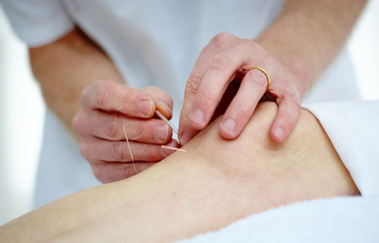 Điện mẵng châm điều trị viêm khớp dạng thấp